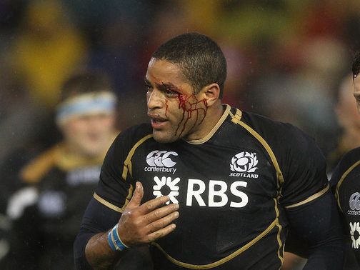 Joe Ansbro: Broke a bone in his neck against Munster