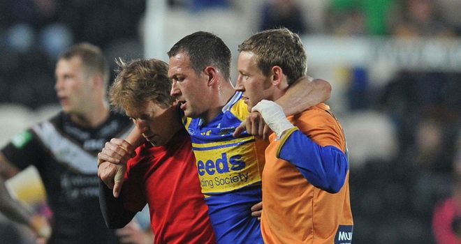 Danny McGuire: Broken fibula