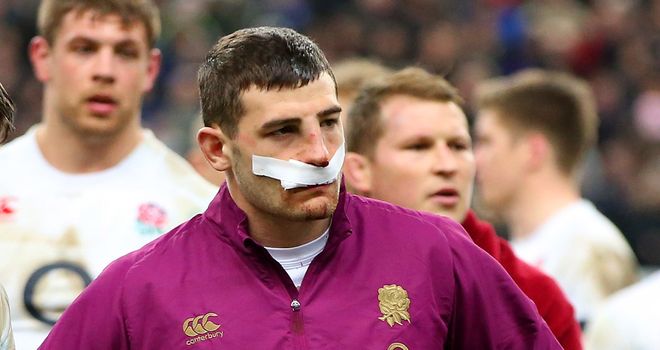 Jonny May: Fit for Calcutta Cup clash despite nasty nose injury