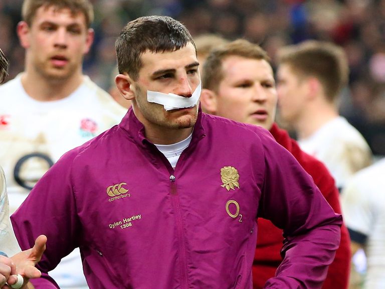 Jonny May: Broken nose