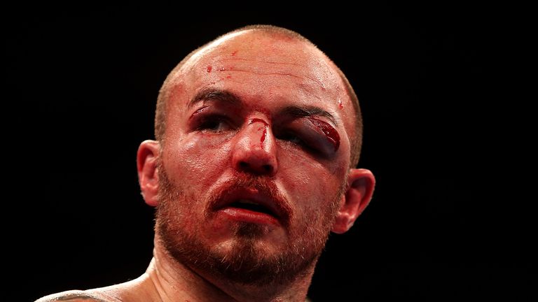 Mitchell was left with a horrendous cut over his left eye