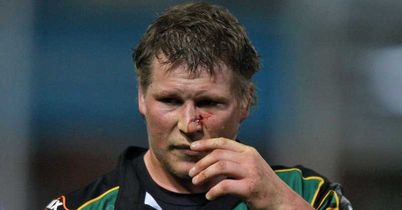 Hartley: Battered and bruised