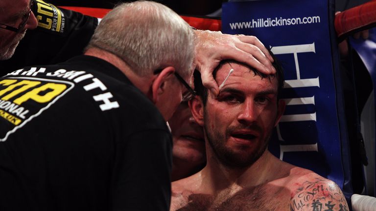 Paul Smith of Liverpool is attended to by his corner between rounds in his fight with James DeGale of Harlsden in their Super-Middleweight Championship of the World fight during the Frank Warren 30 Years anniversary show at Echo Arena on December 11, 2010 in Liverpool, England