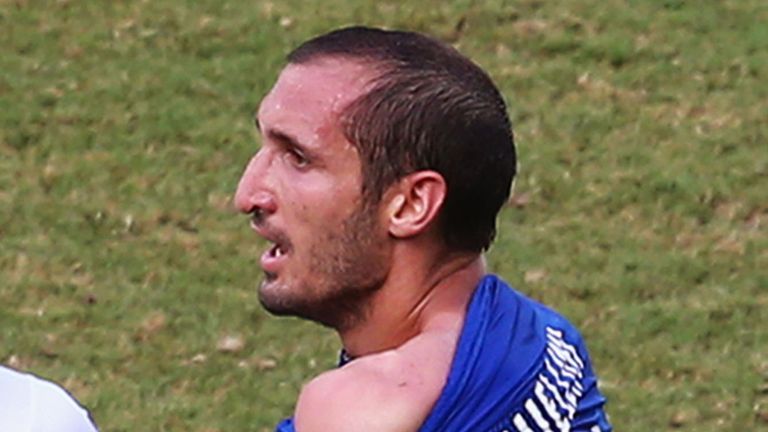 Giorgio Chiellini of Italy pulls down his shirt after a clash with Luis Suarez to show bite marks in World Cup clash with Uruguay