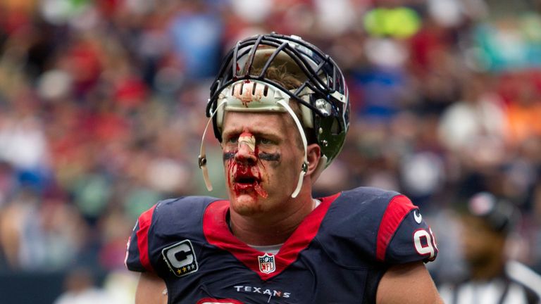 JJ Watt of the Houston Texans comes off the field after suffering a cut to the bridge of his nose against Seattle