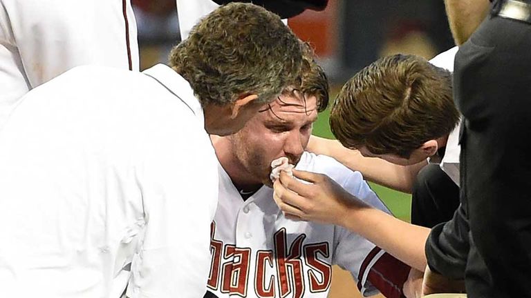 Archie Bradley, Arizona Diamondbacks, being treated by trainers after getting hit in face by baseball