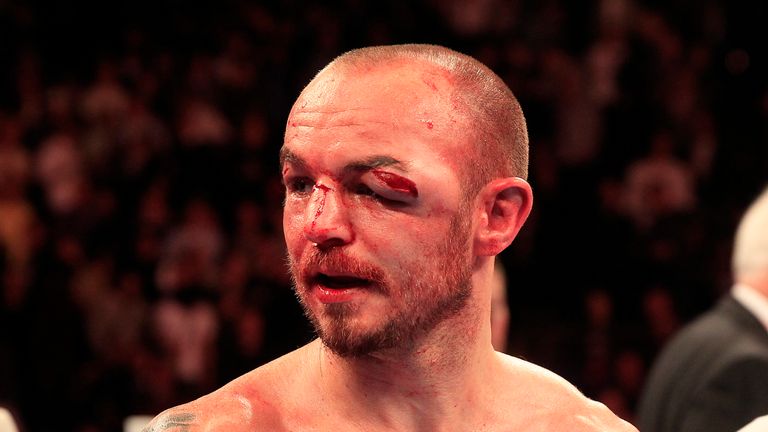 Kevin Mitchell: Lost title bout (Pic by Lawrence Lustig)