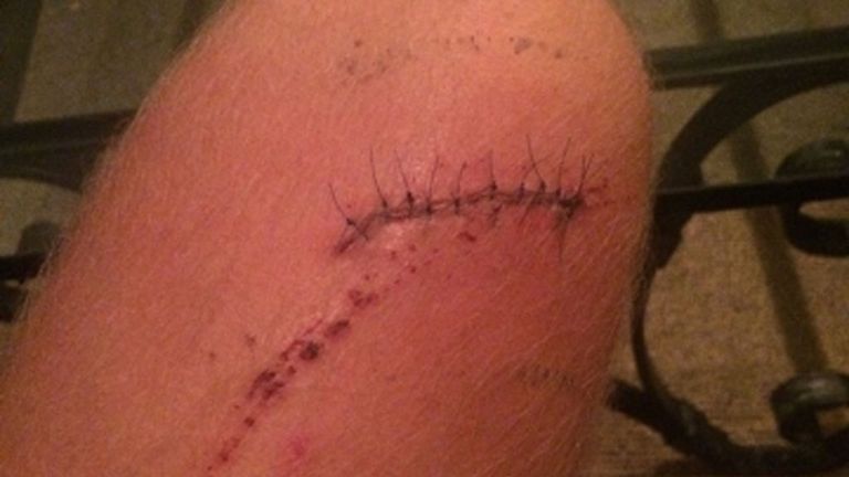 Paul McShane's stitched-up leg: Marouane Fellaini stamp earned Manchester United man three-game ban