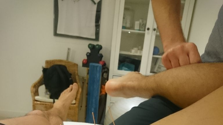 Louis Persent enjoying some acupuncture: Not everybody's cup of tea