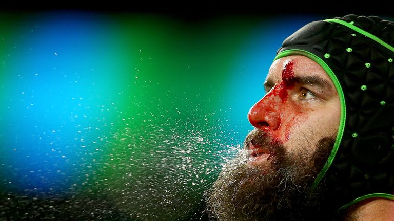 A bloodied Scott Fardy of Australia spits during the 2015 Rugby World Cup Semi Final match between Argentina and Australia