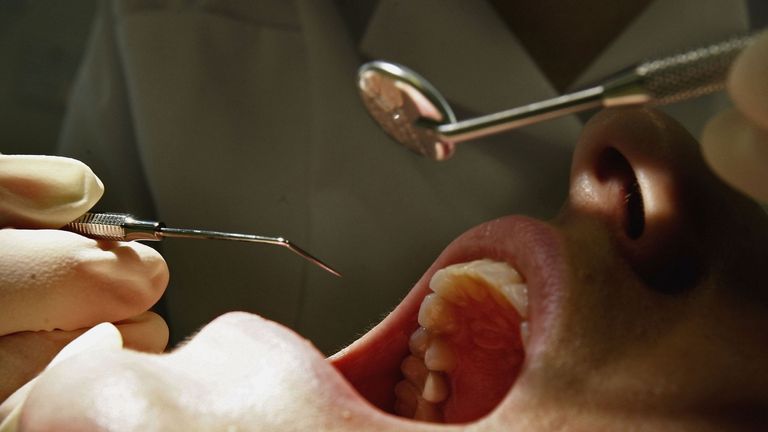 Moret han half of players suffer from dental erosion