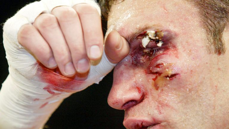 Vitali Klitschko suffered a horrible cut above his left eye