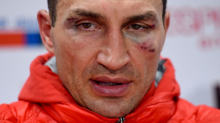 Wladimir Klitschko looks on at the press conference after he lost his world heavyweight title to Tyson Fury