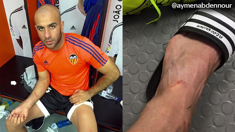 Aymen Abdennour posted these photos on social media. Picture courtesy of @aymenabdennour