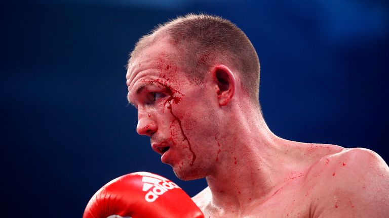 Juergen Braehmer of Germany is injured during their WBA light heavyweight world championship title fight against Eduard Gutknecht 
