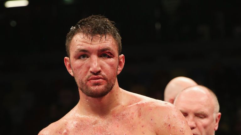Hughie Fury is suffering from a serious skin condition