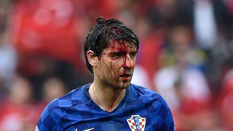 Croatia's defender Vedran Corluka played an hour of the game with a head injury