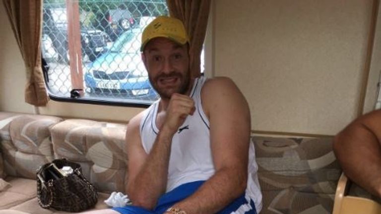 Tyson Fury shows off his sprained ankle - Pic courtesy Peter Fury (@peterfury)