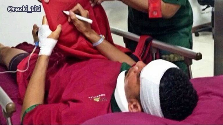 Manchester United defender Chris Smalling has been taken to hospital in Bali after he fell and hit his head.