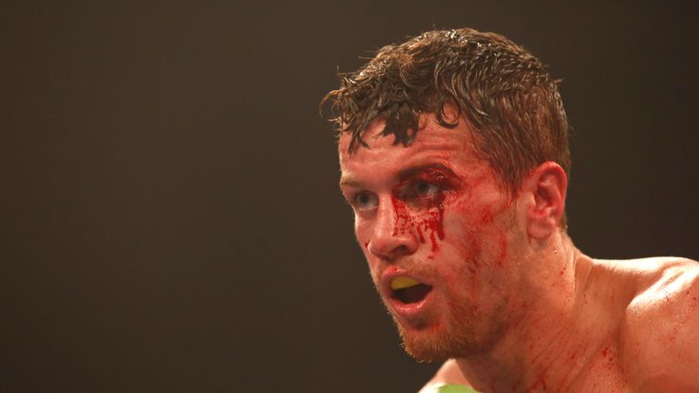 Gary Corcoran sustained a nasty cut against Liam Williams