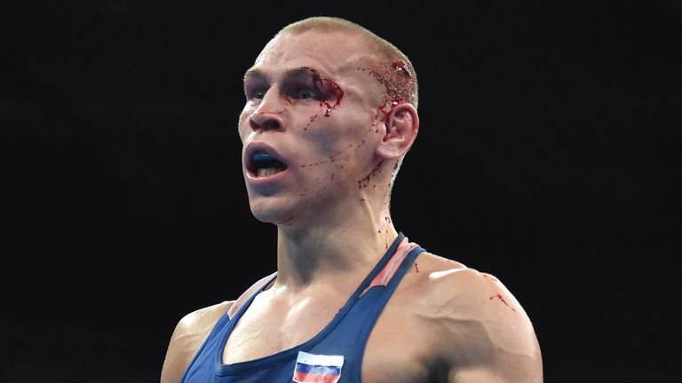 Blood covered Russia's Vladimir Nikitin reacts to winning against Ireland's Michael John Conlan during the Men's Bantam (56kg) QuarterfinalImages)