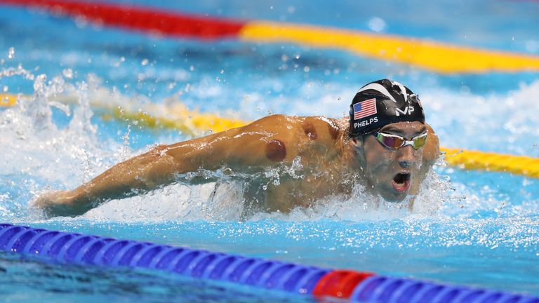 Michael Phelps' right shoulder was dotted with 'cupping' marks in Rio