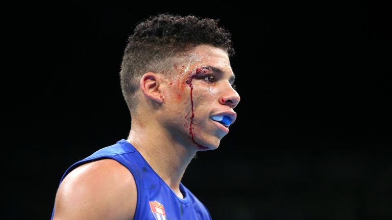 RIO DE JANEIRO, BRAZIL - AUGUST 17:  Yosbany Veitia of Cuba suffers a cut above his right eye while boxing Jianguan Hu of China in the Men's Quarterfinal b
