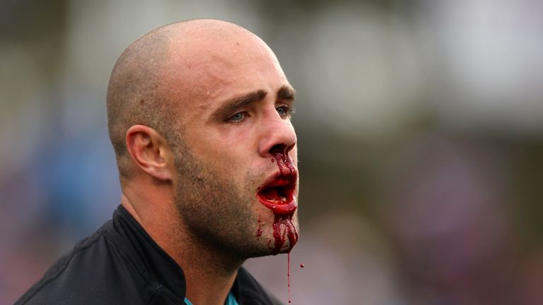 PENRITH, AUSTRALIA - JULY 24:  Adrian Purtell of the Panthers bleeds from the nose during the round 20 NRL match between the Penrith Panthers and the Manly