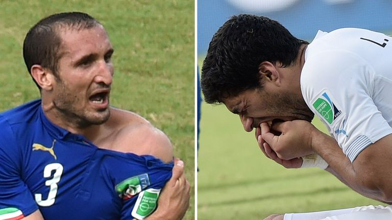 This combo of 2 photos shows Italy's defender Giorgio Chiellini (L) showing an apparent bitemark and Uruguay forward Luis Suarez (R) holding his teeth afte