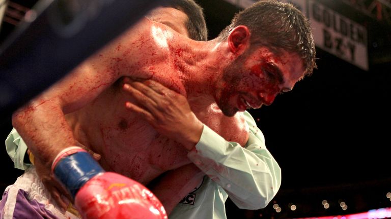 Jorge Linares after defeat to Antonio DeMarco