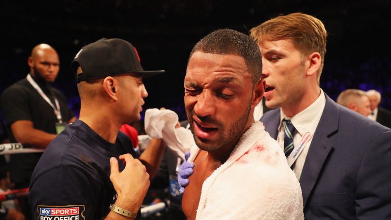 LONDON, ENGLAND - SEPTEMBER 10:  Kell Brook looks on in defeat to Gennady Golovkin after their World Middleweight Title contest at The O2 Arena on Septembe