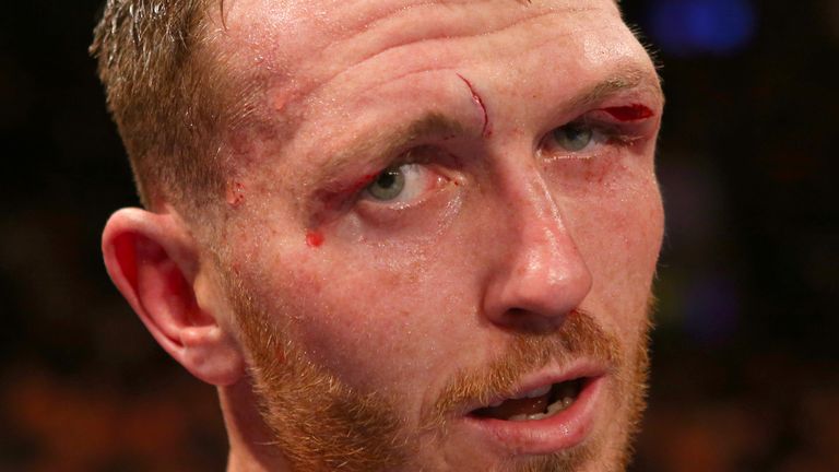 LIVERPOOL, ENGLAND - NOVEMBER 7: Scott Cardle after beating Sean Dodd during their Lightweight contest at the Echo Arena on November 7, 2015 in Liverpool, 