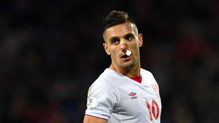  Dusan Tadic of Serbia looks on with an injured nose