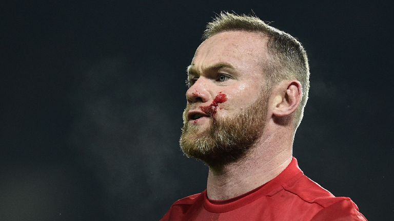 Blood covers the cheek of Manchester United's English striker Wayne Rooney as he remonstrates with referee Mike Jones 