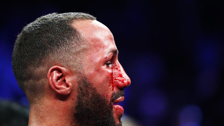 NEW YORK, NY - JANUARY 14:  James DeGale  looks on after his fight with Badou Jack after their WBC/IBF Super Middleweight Unification bout at the Barclays 