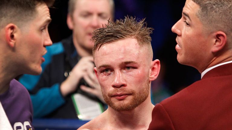 LAS VEGAS, NV - JANUARY 28:  Carl Frampton (C) is shown after losing his WBA featherweight title to Leo Santa Cruz at MGM Grand Garden Arena on January 28,