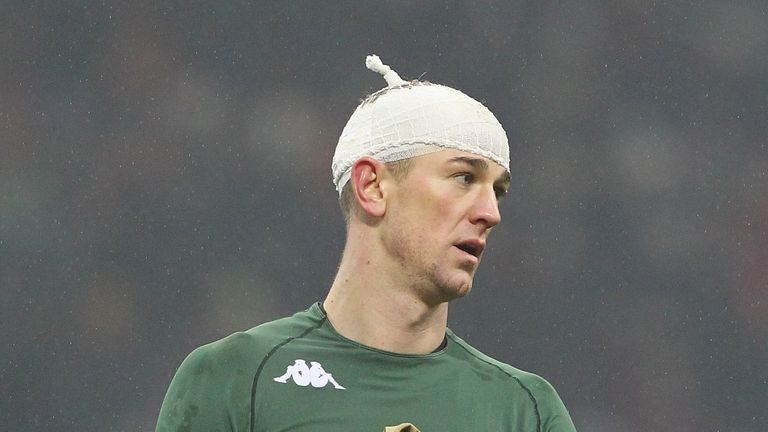 MILAN, ITALY - JANUARY 12:  Joe Hart of Torino FC has his head bandaged at the end of the TIM Cup match between AC Milan and AC Torino at Giuseppe Meazza S