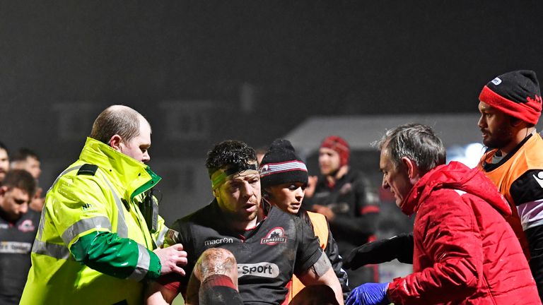 Edinburgh prop Alasdair Dickinson had to be stretchered off