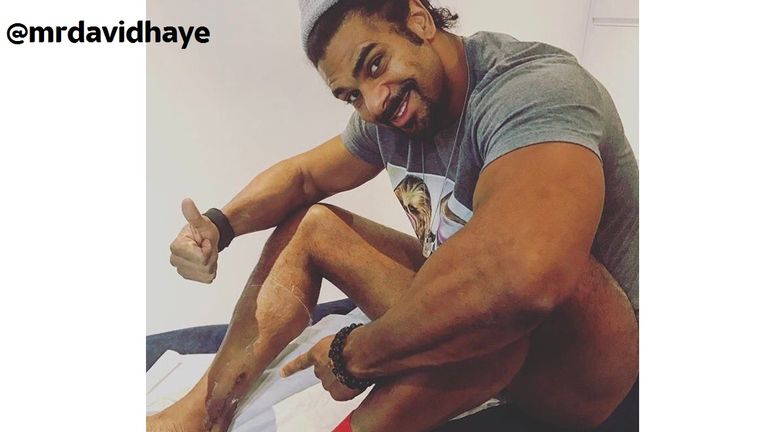 David Haye scar picture shared on social @mrdavidhaye