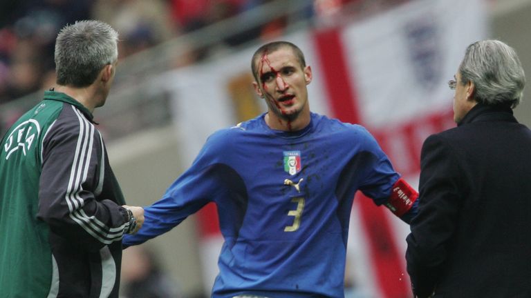 LONDON - MARCH 24:  Giorgio Chiellini looks on a blood pours from his injured head of Italy the U21 International Friendly match between England and Italy 