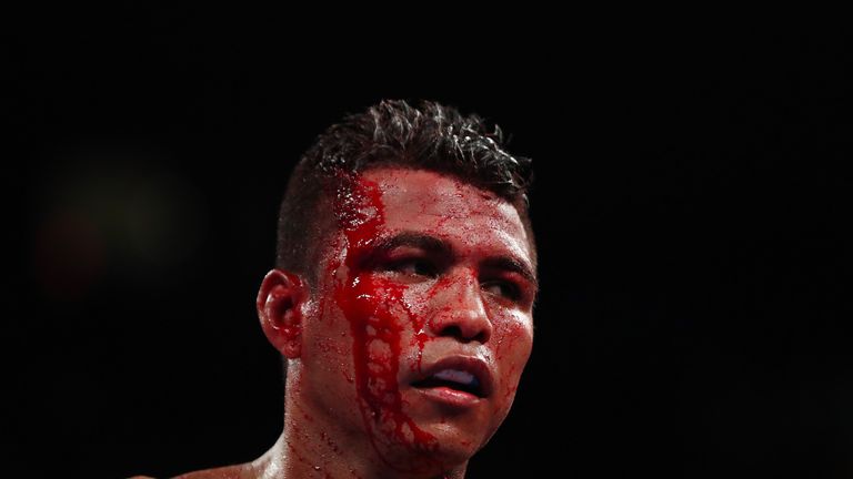 Roman Gonzalez suffered a nasty cut during his bout with Srisaket Sor Rungvisai 