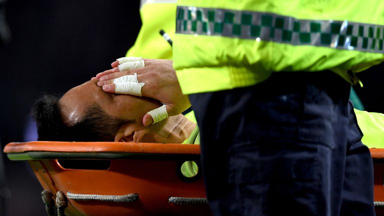 Claudio Bravo of Manchester City is stretchered off during the derby
