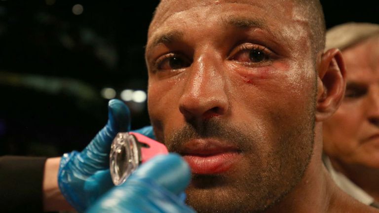 Kell Brook is inspected by the doctor after  loosing in his IBF Welterweight World Championship contest against Errol Spence Jr