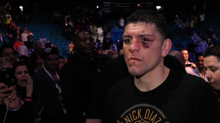 Nick Diaz  leaves the arena after losing to  Anderson Silva in a middleweight bout during UFC 183 