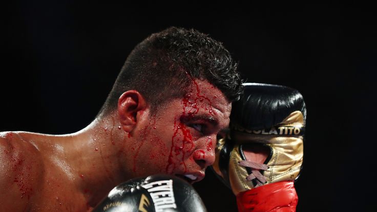 NEW YORK, NY - MARCH 18:  Roman "Chocolatito" Gonzalez is cut against Srisaket Sor Rungvisai  during their Championship fight for Gonzalez's WBC junior ban