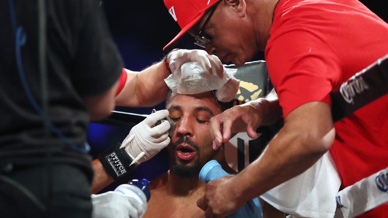 LAS VEGAS, NV - JUNE 17:  Andre Ward is tended to between rounds during his light heavyweight championship bout against Sergey Kovalev at the Mandalay Bay 