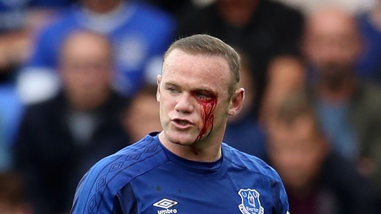 LIVERPOOL, ENGLAND - SEPTEMBER 23: Wayne Rooney of Everton looks on with a facial injury during the Premier League match between Everton and AFC Bournemout
