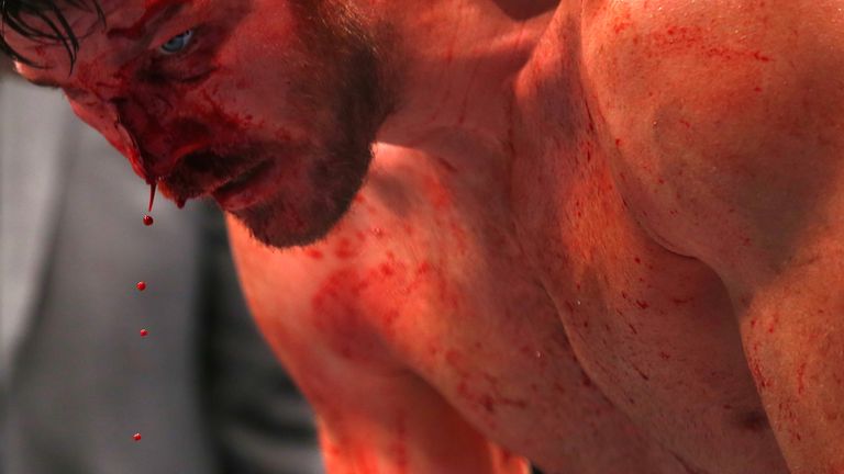 LONDON, ENGLAND - FEBRUARY 27:  The blood pours from Michael Bisping of Great Britain's face as he beats Anderson Silva of Brazil during the Middleweight B