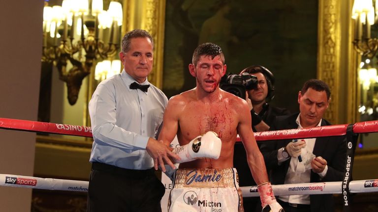 Jamie McDonnell suffered a nasty cut above his left eye after an accidental clash o heads with Liborio Solis