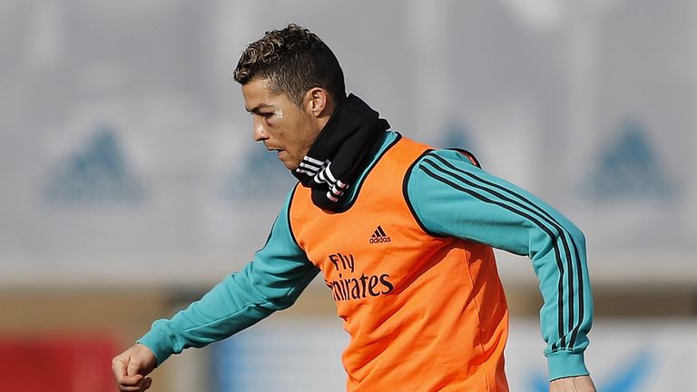 Cristiano Ronaldo is seen with a black eye during a Real Madrid training session at Valdebebas on January 23, 2018